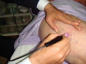 lazer_varis_tedavisi_20101119_1298114045